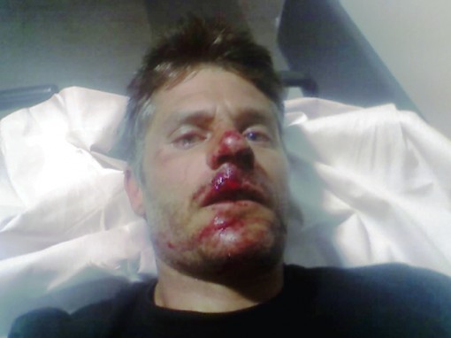 Incidente bici anghileri (2)