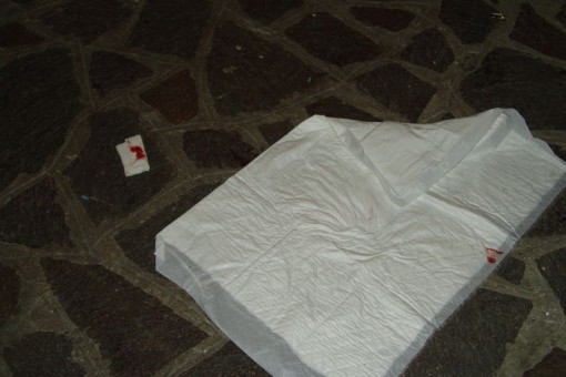 Donna picchiata a Dolzago - 26 febbraio 2014 (3)